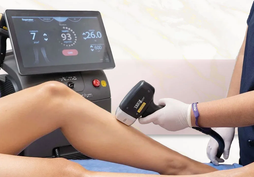 Depilación Soprano Ice - Bioestimulación